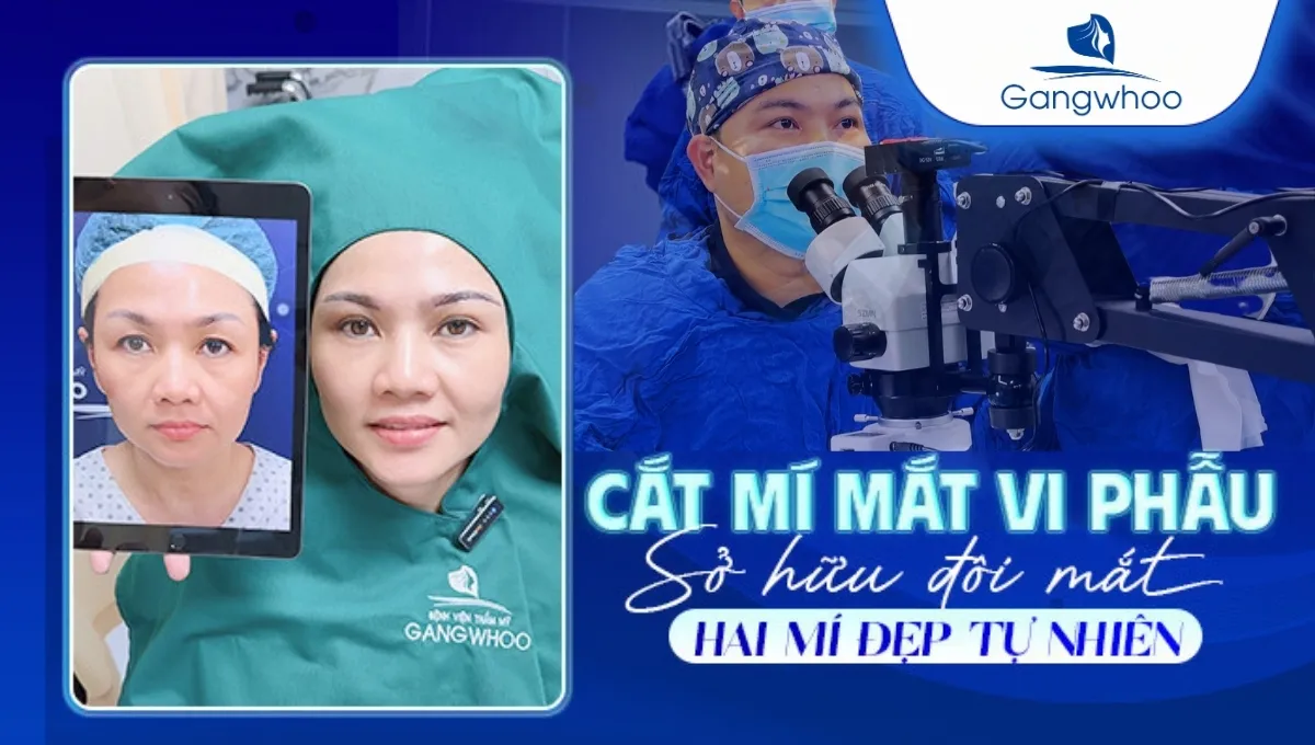 Cắt Mí Mắt Vi Phẫu – Sở Hữu Đôi Mắt 2 Mí Đẹp Tự Nhiên