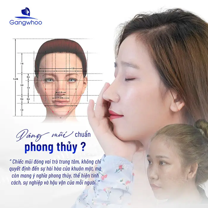 Mài gồ xương mũi thay đổi vận mệnh