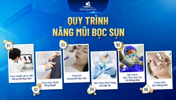 Quy trình nâng mũi bọc sụn tại TMV Gangwhoo