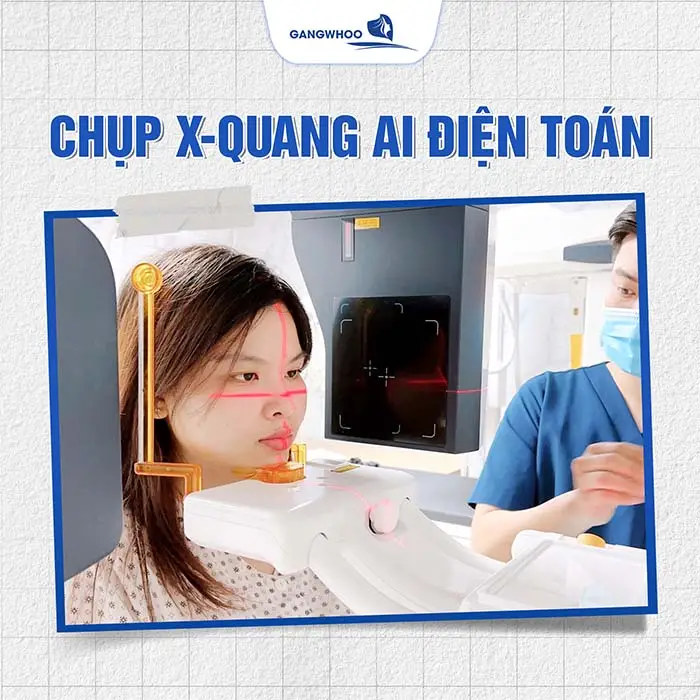 Chụp X-Quang AI điện toán giúp bác sĩ xem rõ cấu trúc mũi của khách hàng