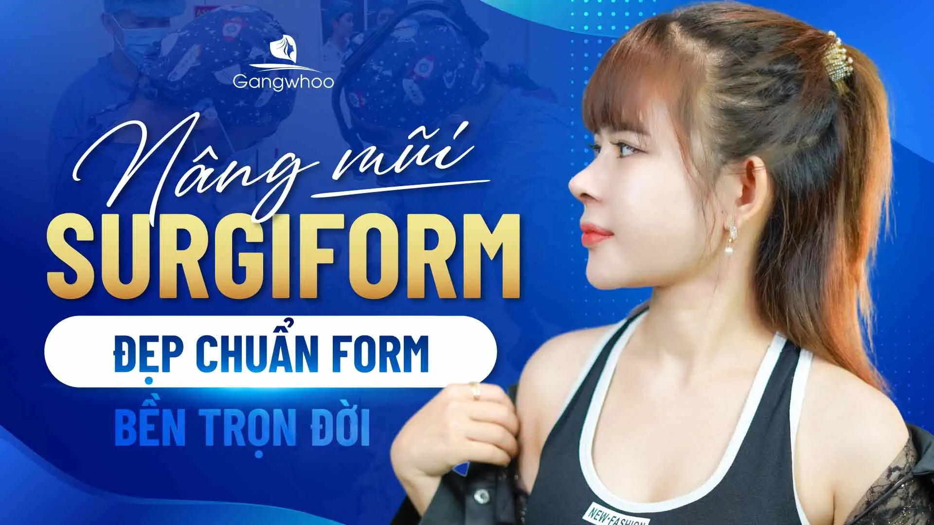 Nâng Mũi Surgiform Là Gì? Nên Nâng Hay Không?