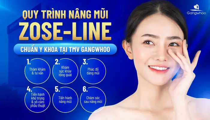 Quy trình nâng mũi chuẩn 6 bước Y khoa