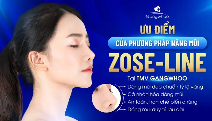 Nâng mũi Zose – Line và 4 ưu điểm vượt trội