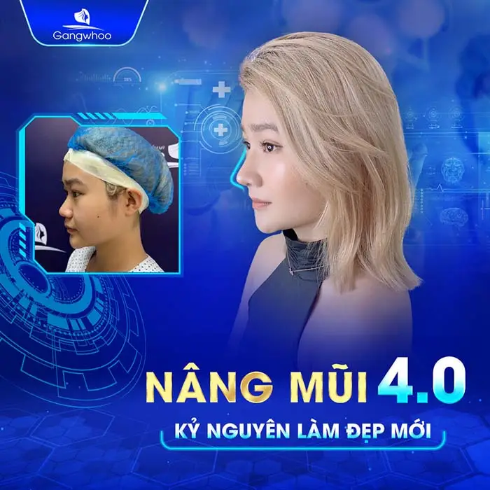 Nâng Mũi Zose – Line: Cá Nhân Hóa Dáng Mũi – Khơi Dậy Cá Tính Riêng