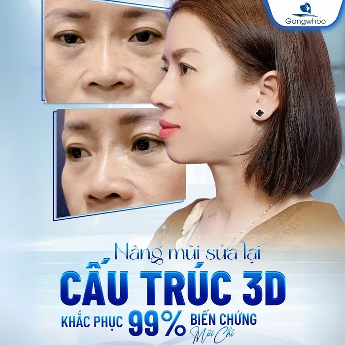 Lấy lại dáng mũi đẹp, tự nhiên nhờ sửa mũi hỏng tại Gangwhoo