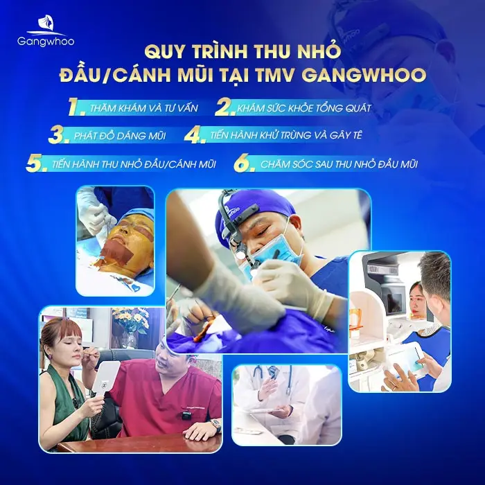 Quy trình thu nhỏ đầu mũi tại TMV Gangwhoo
