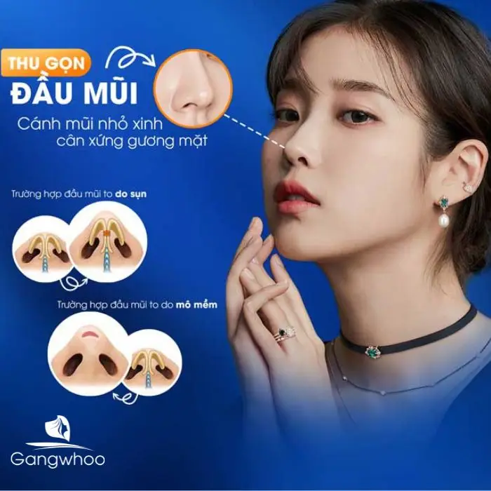 2 phương pháp thu nhỏ đầu mũi được áp dụng phổ biến